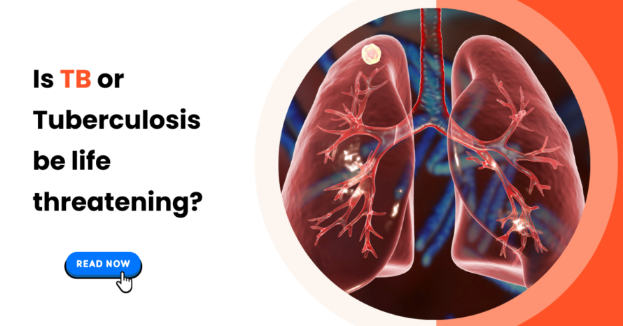 Is TB or Tuberculosis be life threatening?