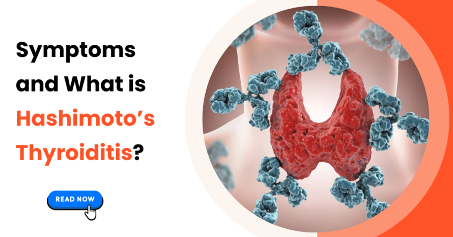 Symptoms and What is Hashimoto’s Thyroiditis?